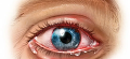 Фокальная инфекция и глазные заболевания