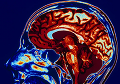 Когда поход к офтальмологу может закончиться МРТ мозга?