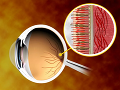 Первая полноценная операция по восстановлению зрения с использованием стволовых клеток