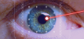 Новый имплантат предотвращает слепоту от глаукомы