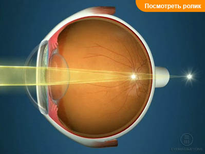 Глазное яблоко