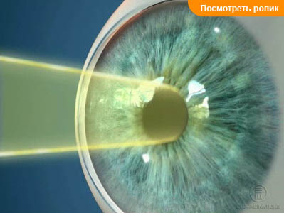 Зрачок
